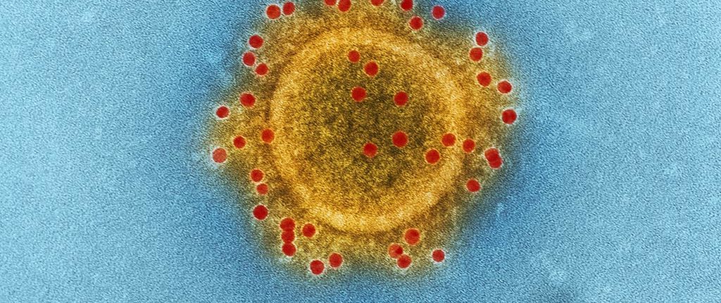 A SAR-CoV-2 virus