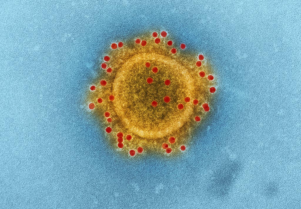 A SAR-CoV-2 virus